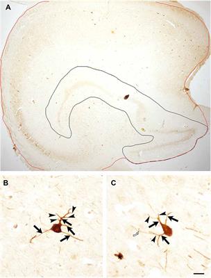 Development of parvalbumin-immunoreactive neurons in the postnatal human hippocampal formation